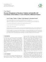 Osseous Metaplasia in Mucinous Tubular and Spindle Cell Carcinoma of the Kidney: A Case of Massive, Bilateral Tumors