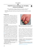 Staphylococcus simulans: An emerging cutaneous pathogen
