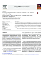 Functional hemispherotomy in Rasmussen syndrome in the absence of classic MRI findings