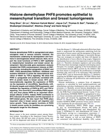 Histone demethylase PHF8 promotes epithelial to mesenchymal transition and breast tumorigenesis