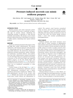 Pressure-induced necrosis can mimic retiform purpura