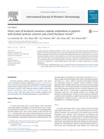 Three cases of localized cutaneous nodular amyloidosis in patients with limited systemic sclerosis and a brief literature review.