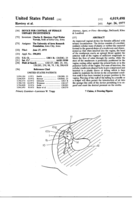 Device for control of female urinary incontinence