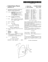 Methods of smoothing segmented regions and related devices