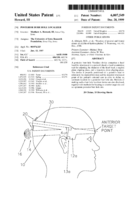 Posterior burr hole localizer