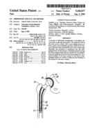Orthopedic implant and method