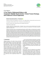 A Case Study of Malrotated Kidneys with Asymmetric Multiple Renal Arteries, Variant Venous Drainage, and Unilateral Ureteral Duplication