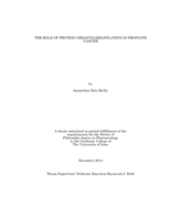 The role of protein geranylgeranylation in prostate cancer