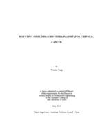 Rotating-shield brachytherapy (RSBT) for cervical cancer
