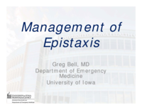 Management of Epistaxis