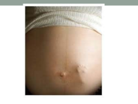Contraceptives Update